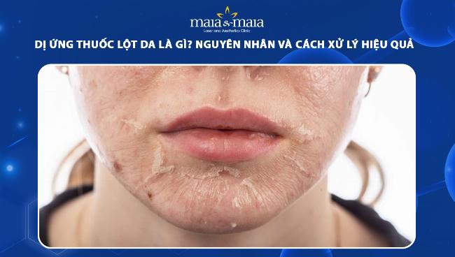 Một số dẫn xuất phổ biến của hợp chất phenol: hydroquinon, resorcinol, axit salicylic
